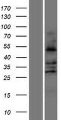 Western Blot: FALDH Overexpression Lysate [NBP2-10666]