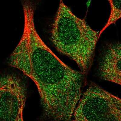 Immunocytochemistry/ Immunofluorescence: FAM100A Antibody [NBP2-38094]
