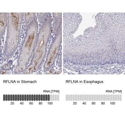 Immunohistochemistry-Paraffin: FAM101A Antibody [NBP2-62722]