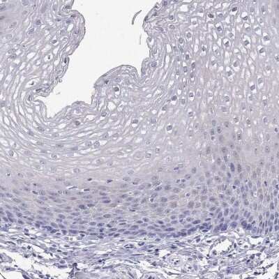 Immunohistochemistry-Paraffin: FAM101A Antibody [NBP2-62722]