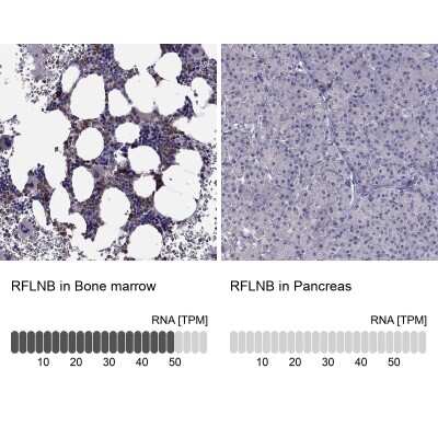 Immunohistochemistry-Paraffin: FAM101B Antibody [NBP2-62633]