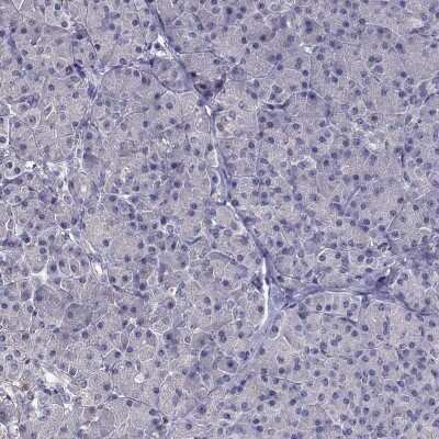 Immunohistochemistry-Paraffin: FAM101B Antibody [NBP2-62633]