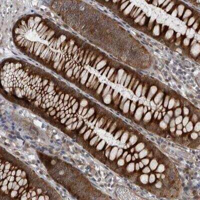 Immunohistochemistry-Paraffin: FAM102B Antibody [NBP1-84085]