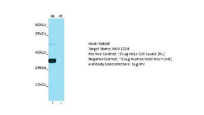 Western Blot: FAM102B Antibody [NBP2-83032]