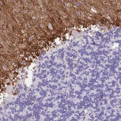 Immunohistochemistry-Paraffin: FAM107A Antibody [NBP2-30589]
