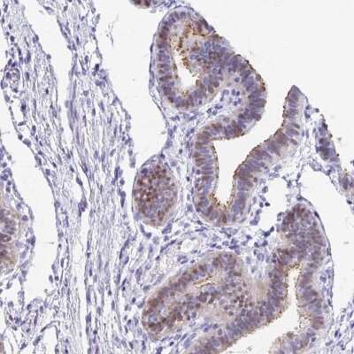Immunohistochemistry-Paraffin: FAM107A Antibody [NBP2-30589]