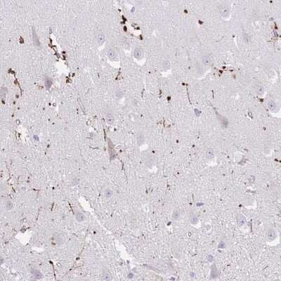 Immunohistochemistry-Paraffin: FAM107A Antibody [NBP2-30589]