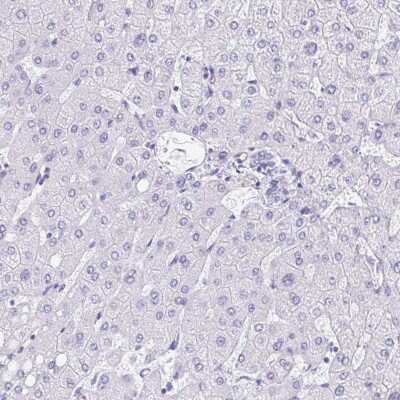 Immunohistochemistry-Paraffin: FAM107A Antibody [NBP2-30589]
