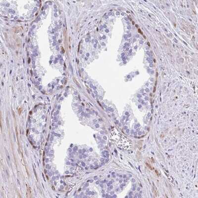 Immunohistochemistry-Paraffin: FAM107A Antibody [NBP2-30589]