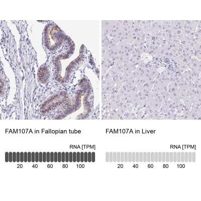 Immunohistochemistry-Paraffin: FAM107A Antibody [NBP2-30589]