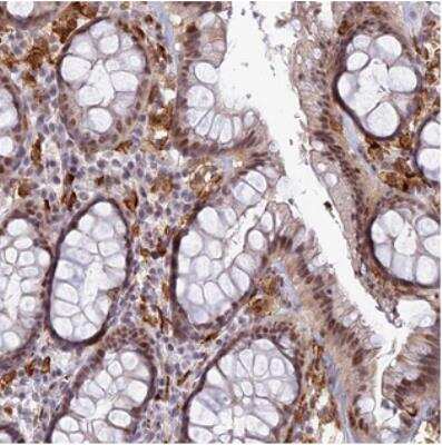 Immunohistochemistry: FAM108A1 Antibody [NBP2-30566]