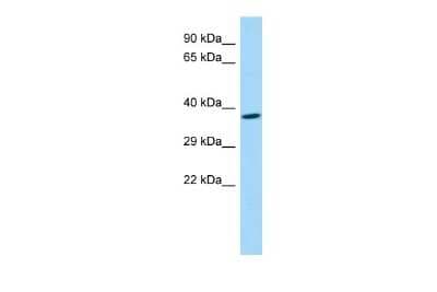 Western Blot: FAM108A1 Antibody [NBP2-84877]