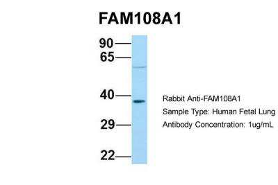 Western Blot: FAM108A1 Antibody [NBP2-84877]