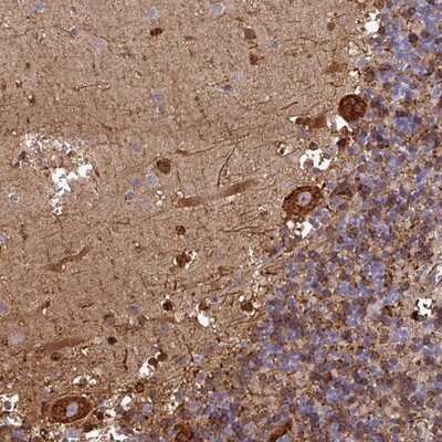 Immunohistochemistry-Paraffin: FAM113A Antibody [NBP2-13976]