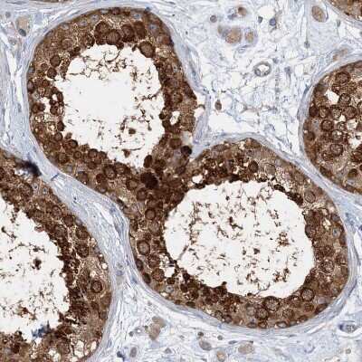 Immunohistochemistry-Paraffin: FAM114A2 Antibody [NBP1-89407]