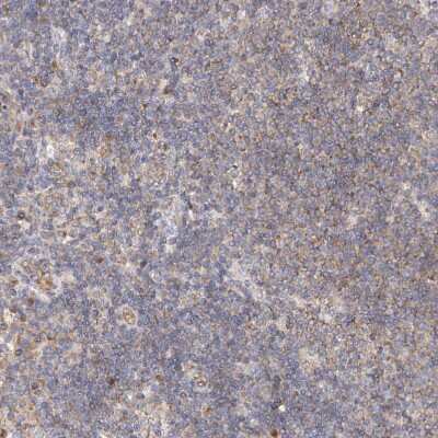 Immunohistochemistry-Paraffin: FAM114A2 Antibody [NBP1-89407]