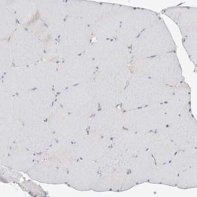 Immunohistochemistry-Paraffin: FAM114A2 Antibody [NBP1-89407]