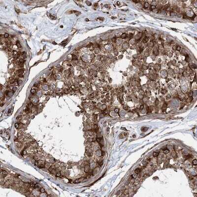 Immunohistochemistry-Paraffin: FAM114A2 Antibody [NBP1-89408]