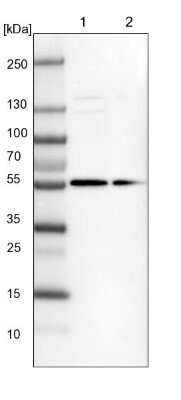 Western Blot: FAM116B Antibody [NBP1-81110]