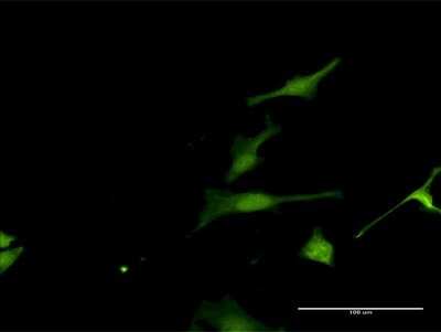 Immunocytochemistry/ Immunofluorescence: FAM117A Antibody [H00081558-D01P]