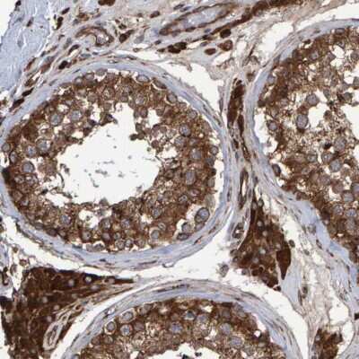Immunohistochemistry-Paraffin: FAM117A Antibody [NBP1-86007]