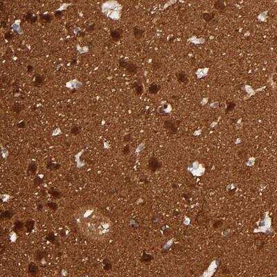 Immunohistochemistry-Paraffin: FAM117B Antibody [NBP1-90861]