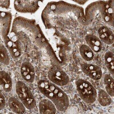 Immunohistochemistry-Paraffin: FAM119A Antibody [NBP1-83282]