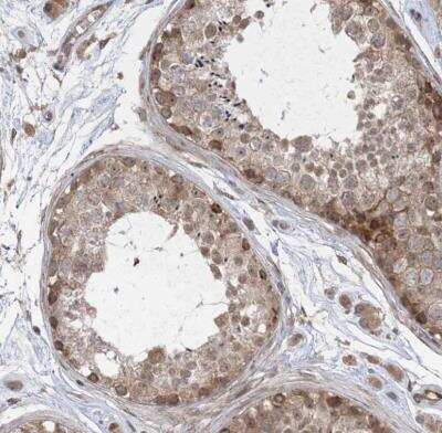 Immunohistochemistry-Paraffin: FAM119A Antibody [NBP1-83282]