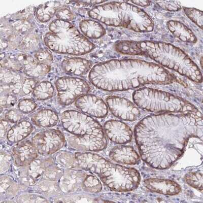 Immunohistochemistry: FAM120A Antibody [NBP2-38771]