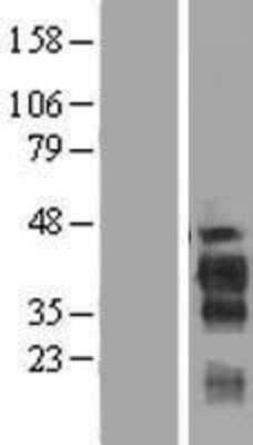 Western Blot: FAM122B Overexpression Lysate [NBP2-05493]
