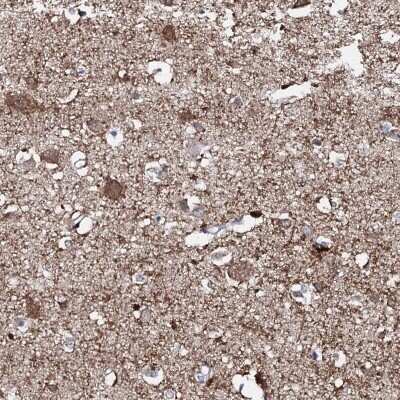Immunohistochemistry-Paraffin: FAM123A Antibody [NBP1-93907]