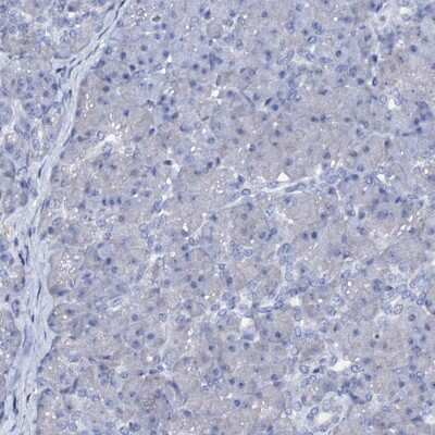 Immunohistochemistry-Paraffin: FAM123A Antibody [NBP1-93907]