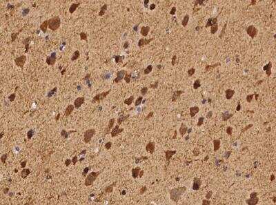 Immunohistochemistry-Paraffin: FAM123A Antibody [NBP3-05964]