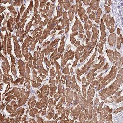 Immunohistochemistry-Paraffin: FAM124A Antibody [NBP2-13978]