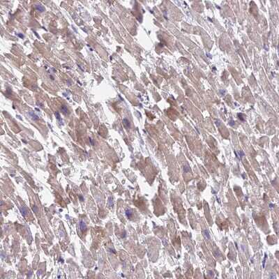 Immunohistochemistry-Paraffin: FAM125A Antibody [NBP1-91882]