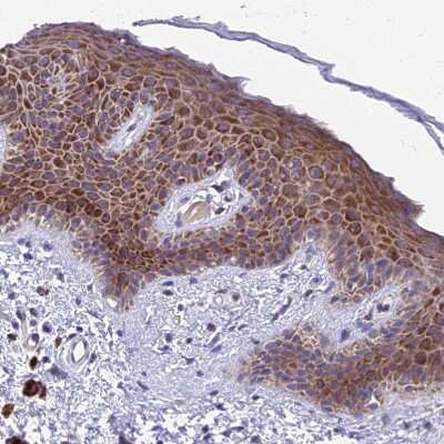 Immunohistochemistry-Paraffin: FAM125A Antibody [NBP1-91882]