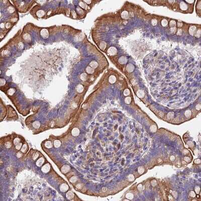 Immunohistochemistry-Paraffin: FAM125A Antibody [NBP1-91882]