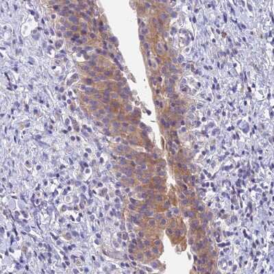Immunohistochemistry-Paraffin: FAM125A Antibody [NBP1-91882]
