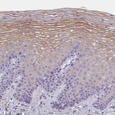 Immunohistochemistry-Paraffin: FAM125A Antibody [NBP1-91883]