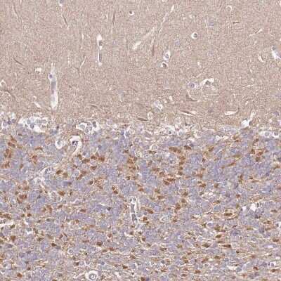 Immunohistochemistry-Paraffin: FAM126B Antibody [NBP2-34026]