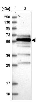 Western Blot: FAM126B Antibody [NBP2-34026]