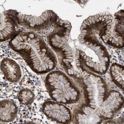 Immunohistochemistry-Paraffin: FAM130A1 Antibody [NBP1-89908]