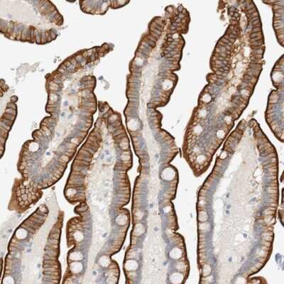 Immunohistochemistry-Paraffin: Adipolin/FAM132A Antibody [NBP1-90700]
