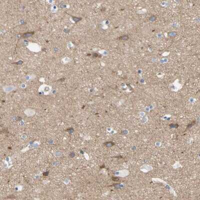 Immunohistochemistry-Paraffin: FAM134A Antibody [NBP1-91168]