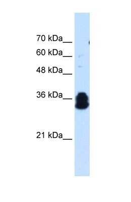 Western Blot: FAM134B Antibody [NBP1-59817]