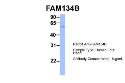 Western Blot: FAM134B Antibody [NBP1-59924]