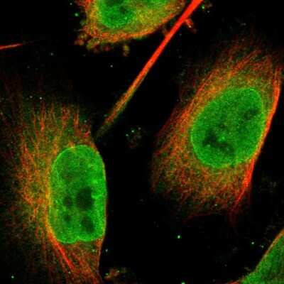 Immunocytochemistry/ Immunofluorescence: FAM134C Antibody [NBP1-85053]