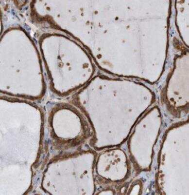 Immunohistochemistry-Paraffin: FAM136A Antibody [NBP1-82227]