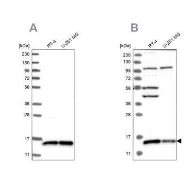 Western Blot: FAM136A Antibody [NBP1-82226]