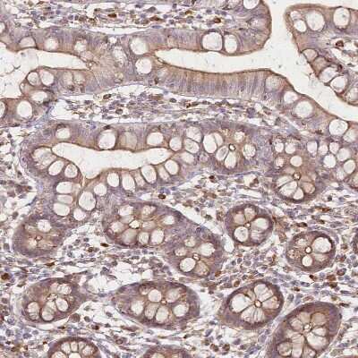 Immunohistochemistry-Paraffin: FAM13A Antibody [NBP1-88825]